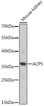 Anti-ACP5 Antibody (CAB16338)