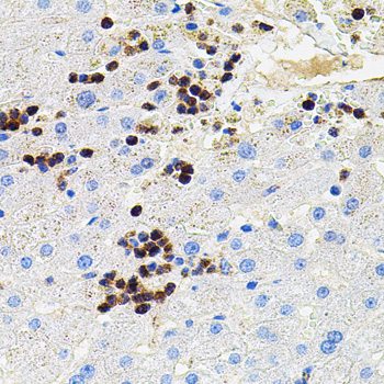 Anti-MMP9 Antibody (CAB11521)