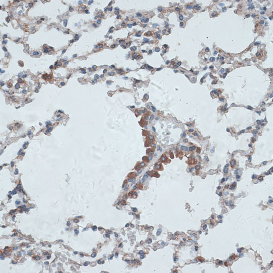 Anti-PMEPA1 Antibody (CAB16555)