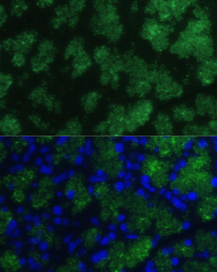 Anti-CTRB1 Antibody (CAB15043)