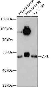 Anti-AK8 Antibody (CAB13761)