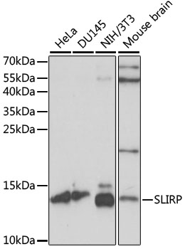 Anti-SLIRP Antibody (CAB15524)