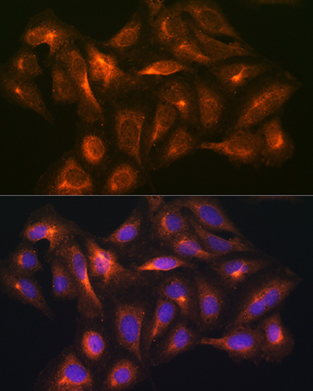 Anti-GAD1 Antibody (CAB2938)