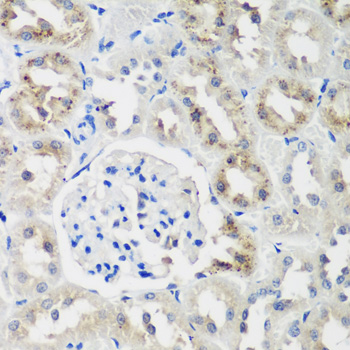 Anti-NEDD4L Polyclonal Antibody (CAB8085)
