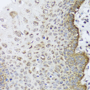 Anti-FANCL Antibody (CAB6812)