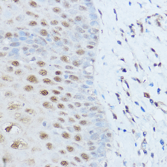 Anti-SMARCD2 Antibody (CAB12104)