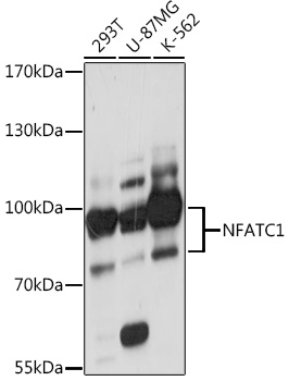 Anti-NFATC1 Antibody (CAB16928)