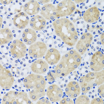 Anti-FGF13 Antibody (CAB7895)