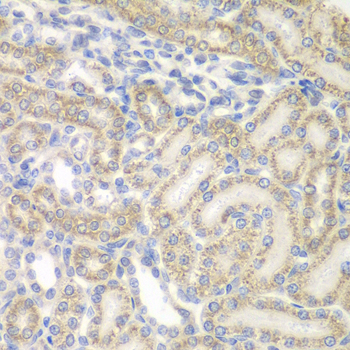 Anti-AUH Antibody (CAB7424)