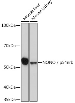 Anti-NONO / p54nrb Antibody (CAB3800)