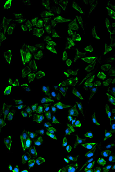 Anti-TPM3 Antibody (CAB1206)