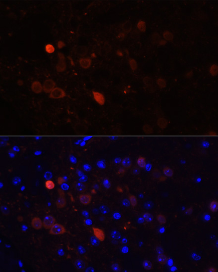 Anti-Calretinin Polyclonal Antibody (CAB9807)