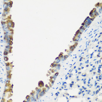 Anti-TNNC2 Antibody (CAB7740)