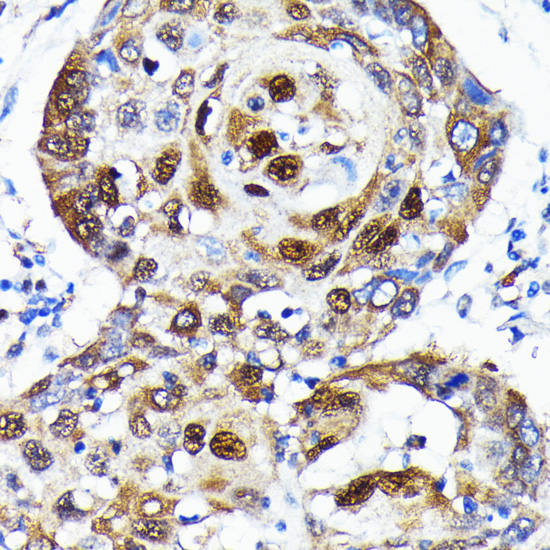 Anti-SQSTM1 / p62 Antibody [KO Validated] (CAB19700)