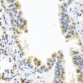 Anti-CALCB Polyclonal Antibody (CAB8105)