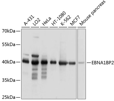 Anti-EBNA1BP2 Polyclonal Antibody (CAB9153)