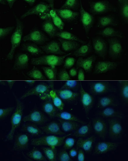 Anti-ZWINT Antibody (CAB6328)