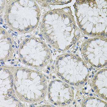 Anti-Bcl-W Antibody (CAB1158)