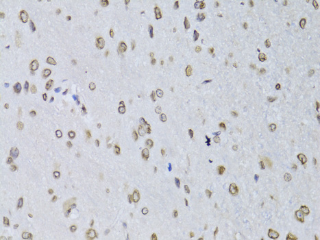 Anti-LMNB2 Antibody (CAB6483)