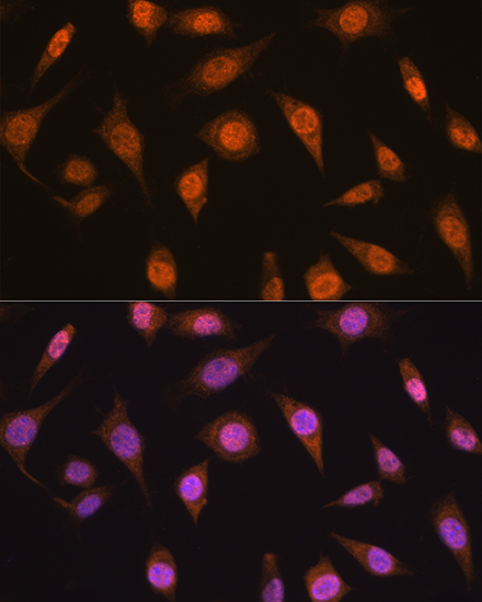 Anti-MAD2L2 Antibody (CAB12559)