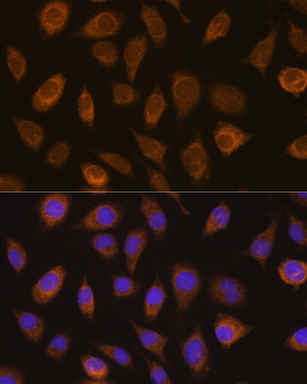 Anti-VHL Antibody (CAB16287)