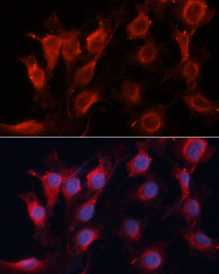 Anti-VEGF Antibody (CAB12303)