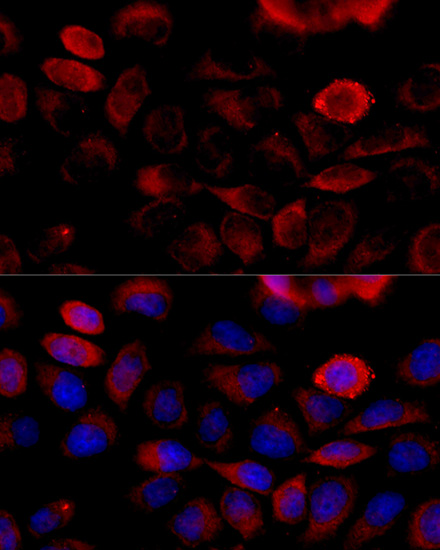 Anti-FGFR2 Antibody (CAB12436)