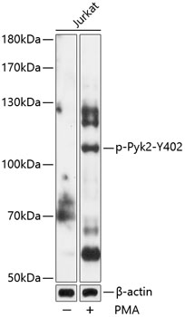 Anti-Phospho-Pyk2-Y402 Antibody (CABP0612)