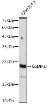 Anti-GSDMD (Full Length+C terminal) Antibody (CAB17308)