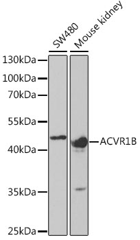 Anti-ACVR1B Antibody (CAB5453)