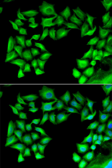 Anti-TIMP4 Antibody (CAB6416)