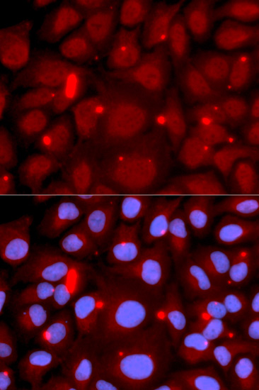 Anti-PADI4 Antibody (CAB1906)