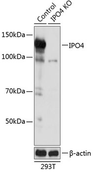 Anti-IPO4 Antibody [KO Validated] (CAB19902)