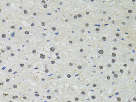 Anti-PPP4C Antibody (CAB2109)