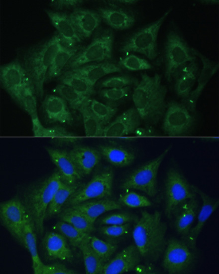 Anti-IGF2BP2 Antibody (CAB1774)