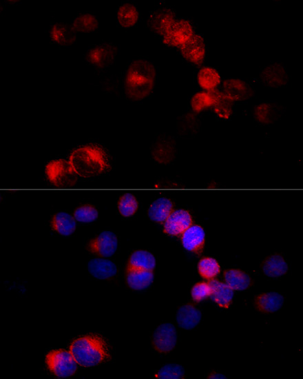 Anti-CYP27A1 Antibody (CAB1982)