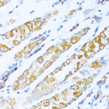 Anti-NDUFA5 Antibody [KO Validated] (CAB14751)