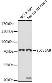 Anti-SLC26A9 Antibody (CAB18530)