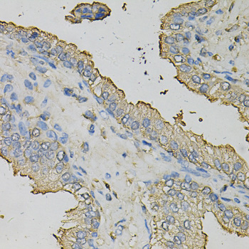 Anti-AZGP1 Antibody (CAB5365)