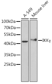 Anti-IKKGamma Antibody [KO Validated] (CAB12536)