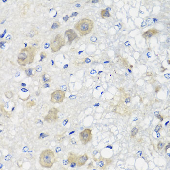 Anti-SHMT1 Antibody (CAB7727)