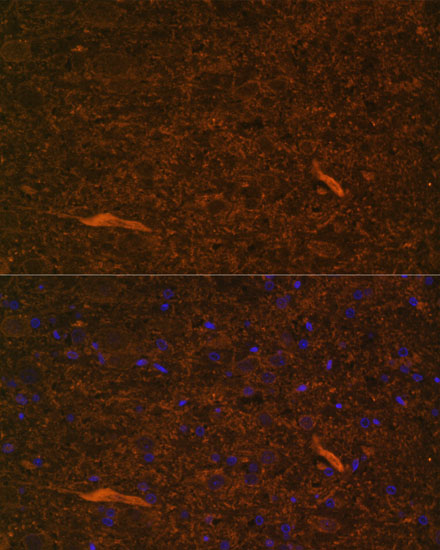 Anti-TEK Antibody (CAB7222)