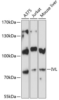 Anti-IVL Polyclonal Antibody (CAB8026)