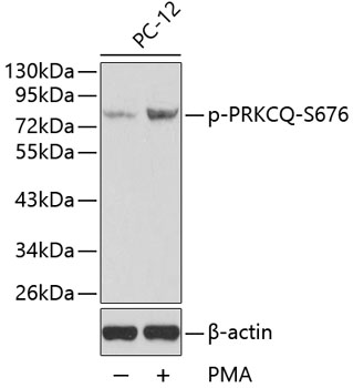 Anti-Phospho-PRKCQ-S676 Antibody (CABP0260)