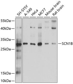 Anti-SCN1B Antibody (CAB10071)