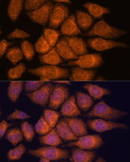 Anti-UPF3A Antibody (CAB15893)