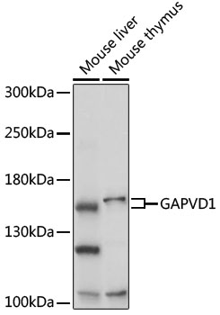 Anti-GAPVD1 Antibody (CAB17127)