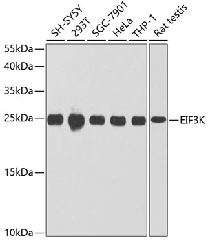 Anti-EIF3K Polyclonal Antibody (CAB9969)