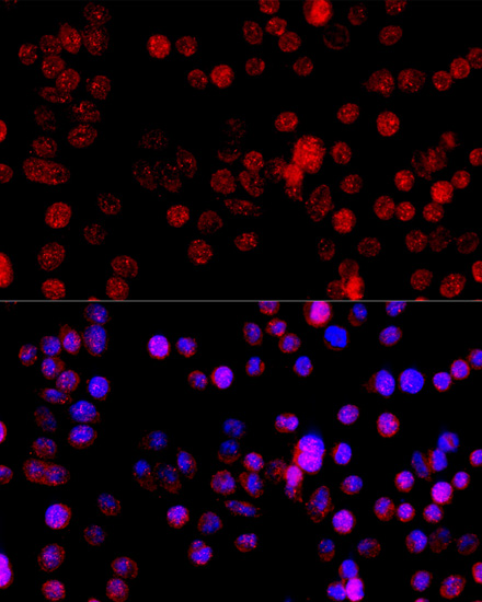 Anti-CYP1B1 Antibody (CAB13967)