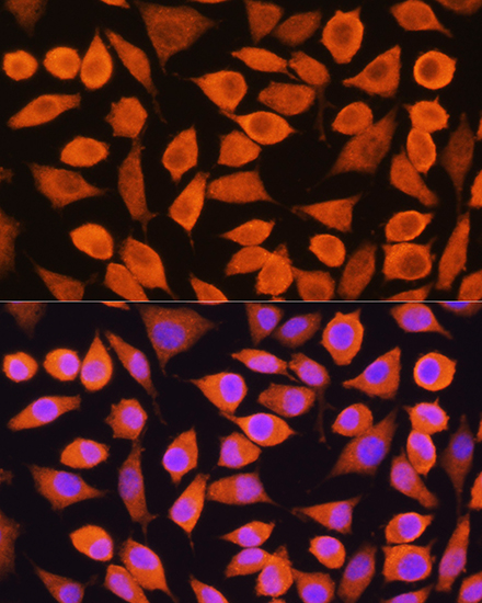 Anti-KRT5 Antibody (CAB2662)